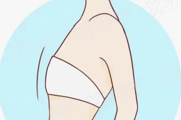 岳莉冈医生做隆胸价格表全曝光：曼托29800+傲诺拉星熠45800+