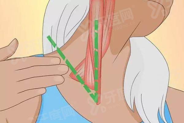 罗延平vs柳超磨骨技术谁更好？都好，罗延平擅长长曲线下颌角截骨，柳超精于颧骨降低术