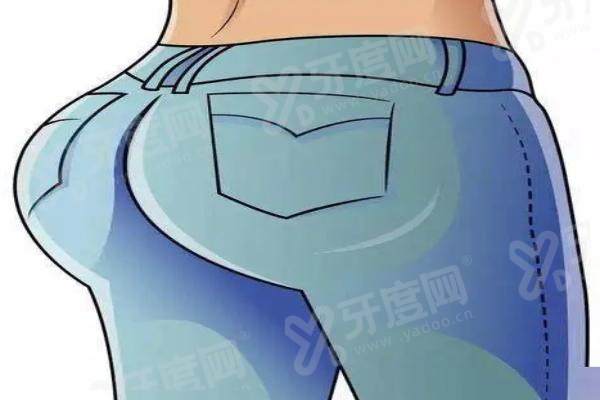 深圳福雅假体丰臀手术需要多长时间？全程约3 - 4小时，附详细深圳福雅假体丰臀价格表！