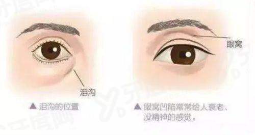 三、谭敏峰医生预约挂号流程?