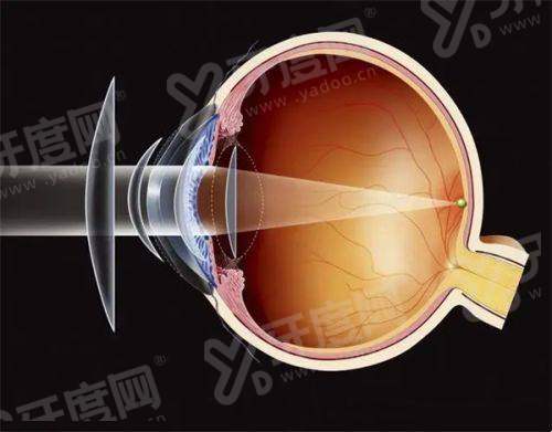 上海未来视界眼科预约挂号流程超清晰！家长带娃配眼镜秒懂～