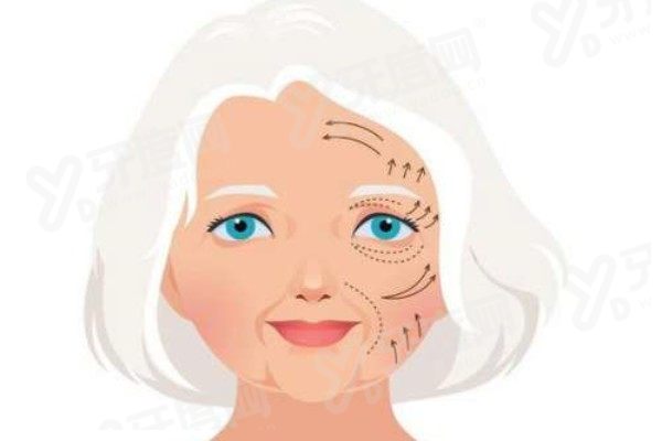 卢丙仑医生的拉皮手术的价格：传统大拉皮手术2.5w+内窥镜辅助拉皮5.8w+