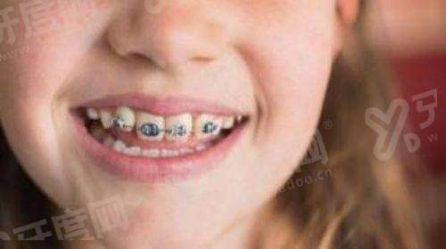 广州固德口腔医院怎么样？解决牙槽骨差/复杂根管问题，价格透明还在天河核心商圈！