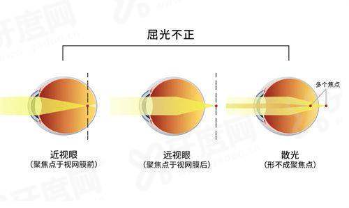惠州爱尔眼科是正规眼科医院吗？肯定的，透明价目表+江北核心区地址！
