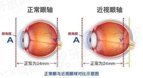 二、沧州爱眼眼科医院具体位置怎么找？附“懒人导航攻略”！
