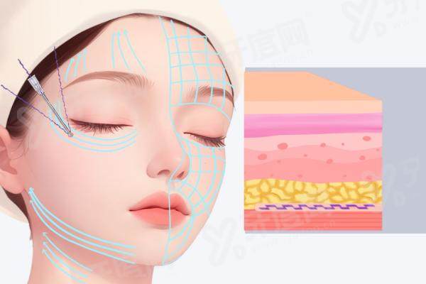 济南拉皮手术医院排名前十：济南艺星/济南美莱/济南韩氏技术好 排名靠前