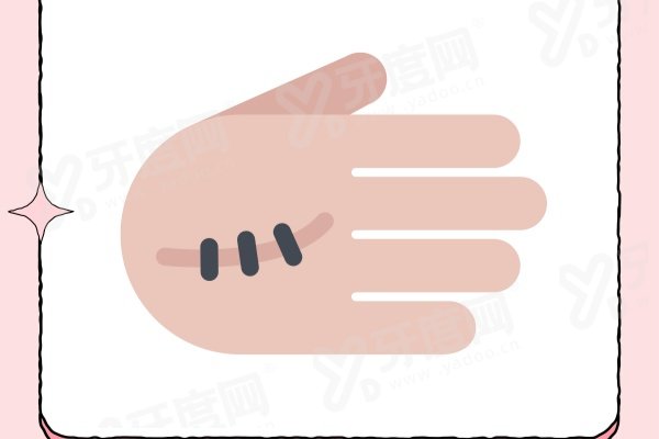 苏映军祛疤医生在哪个医院？就在西安国际医学中心医院，其祛疤技术超厉害解析来啦！