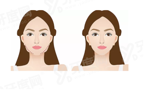 深圳王乙立在泽棠整形医院坐诊，看王乙立医生深圳医院简介，可预约做无痕筋膜提升