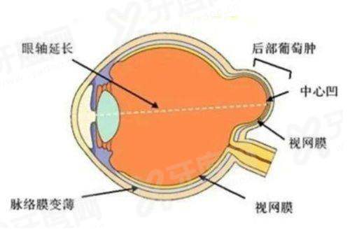 阿玛施眼科全飞秒激光中心咋样？哥弟14年深耕，微创技术+同仁专家超放心！