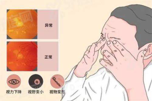 三、 上海和平眼科翟爱琴做晶体植入手术，为什么选她？