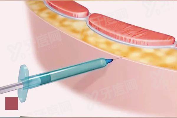 成都李建钢和卢元刚谁厉害些？李建钢擅长鼻部整形，卢元刚擅长眼部整形