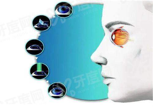 二、 西安大差市四院眼科怎么预约骨干医生号?(热门问题解答)yanke.yadoo.cn