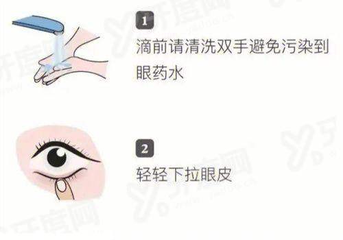 二、西安四院眼科马波好还是王从毅好？看“真实实例”更直观yanke.yadoo.cn