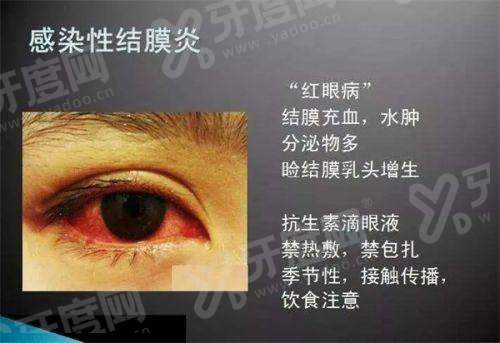 三、西安高新医院眼科段宇辉医生做ICL怎么样？高度近视患者的“福音”yanke.yadoo.cn