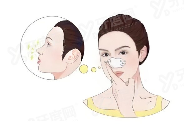 上海梁亮做鼻子多少钱？常规鼻型1W+/高难度鼻修复3W+/挛缩畸形鼻修复5W+