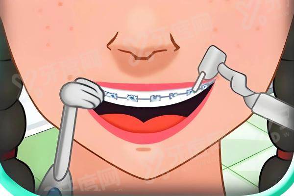 东方修安口腔医院怎么样？正规靠谱种植矫正技术优！地址在解放东路123号，电话400**