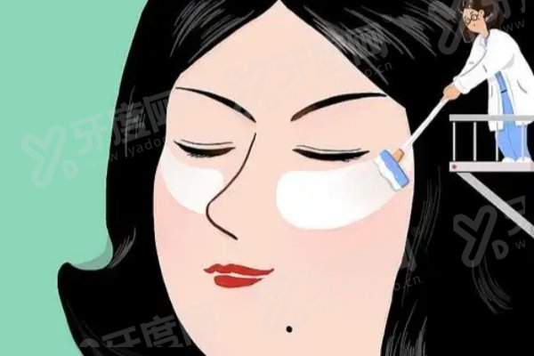 上海张楚双眼皮修复多少钱？轻度双眼皮修复18000+中度双眼皮修复25000+