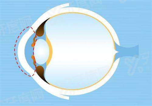 三、 宁德眼科医院挂号网上预约查询：这3家医院值得选，理由超实在！yanke.yadoo.cn