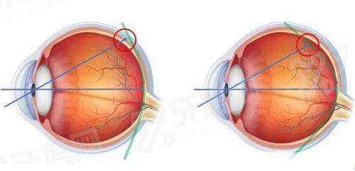 二、 抚州华厦光明眼科医院口碑好吗?看看这些“不一样”的细节就知道yanke.yadoo.cn