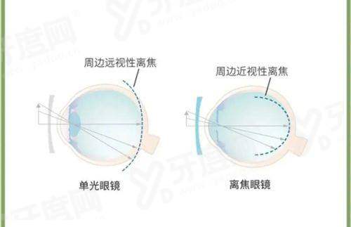二、青岛鲁东眼科医院配镜靠谱吗？这3点“硬实力”让你放心yanke.yadoo.cn