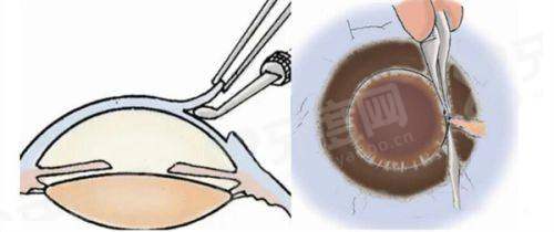 二、 抚州光明眼科医院怎么预约挂号？这些隐藏优势你要知道！yanke.yadoo.cn