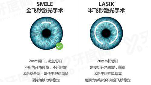 四、北京茗视光眼科可靠吗？看真实患者的反馈就知道yanke.yadoo.cn