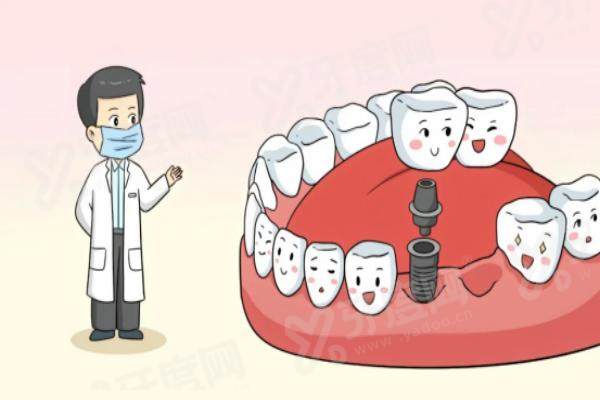 滁州德任口腔医院地址在哪？其数字化种植牙技术超赞，高性价比获众多患者认可！ 