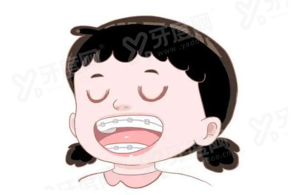 重庆忠县渝状元口腔收费价格表：洗牙99元起/补牙150元起/种植牙3980元起，就诊地址看这里！