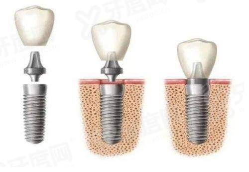 二、苏州美奥口腔医院收费高吗yanke.yadoo.cn