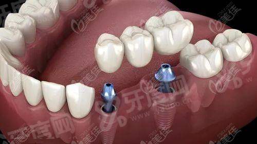 二、泌阳县华瑞口腔医院地址及电话