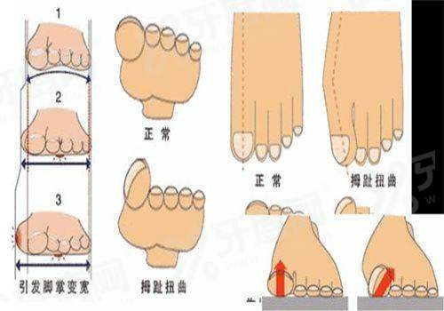 二、骨韧双修术维持多久yanke.yadoo.cn