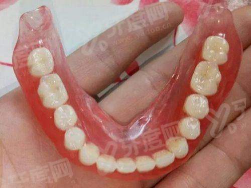 三、全瓷牙优缺点？（优点突出，缺点可通过合理选择规避）yanke.yadoo.cn
