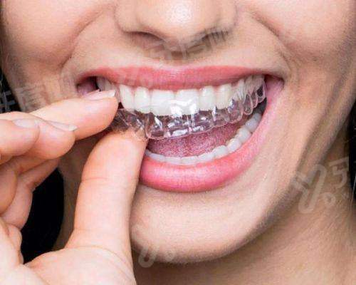 二、南方医 科 大学口腔医院怎么样？（技术精良、医生专精、服务优质）yanke.yadoo.cn