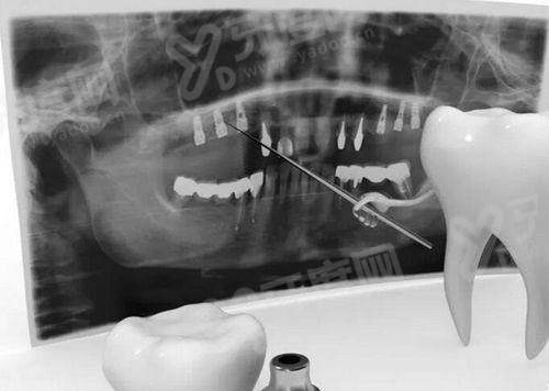 二、南方医 科 大学口腔医院怎么挂号？（多种预约方式，操作简单便捷）yanke.yadoo.cn