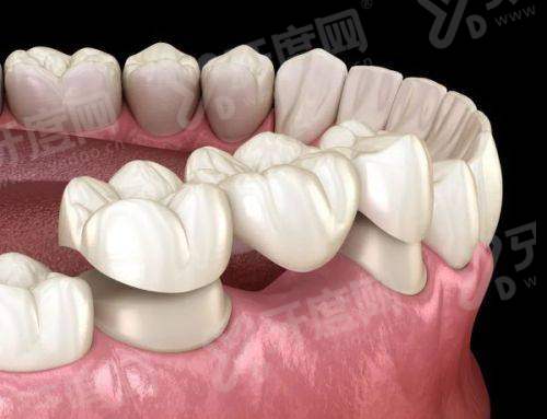 三、镇江康洁口腔万科店怎么样？正规靠谱吗？看完这3点就放心了yanke.yadoo.cn