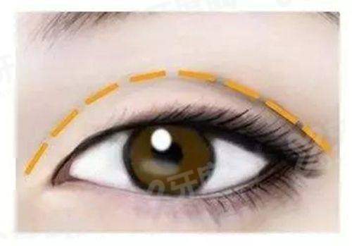 李欣豫医生收费价目表：双眼皮2W/眼综合5W/眼部修复10W元起