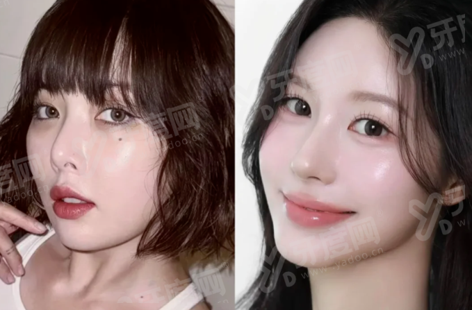 二、郭玉瑞面部提升成效怎么样yanke.yadoo.cn