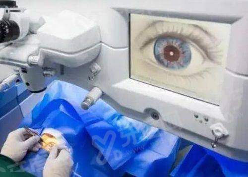 普瑞眼科是私立医院：做近视手术技术娴熟，附价目表