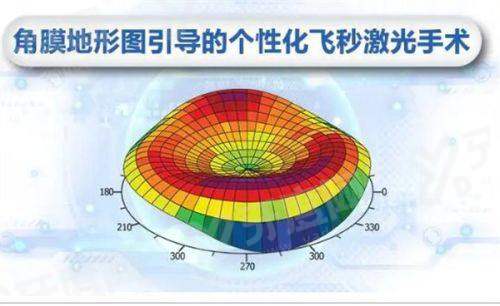 爱尔眼科圆锥角膜手术价目表：交联5k+/板层移植手术8k+元起