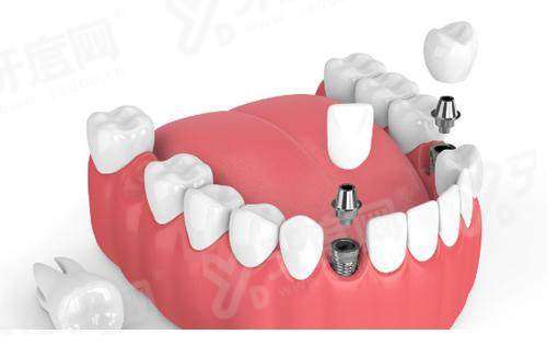深圳龙华人民医院口腔科预约挂号：在线/电话等预约方式超方便，口腔科在门诊5楼