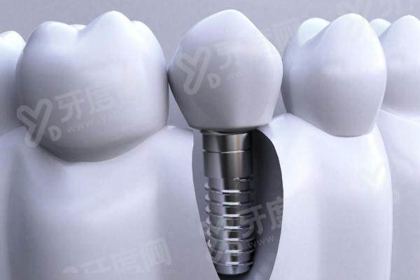 大连国诚口腔怎么预约挂号？1分钟搞定！本地二级专科+核心三院