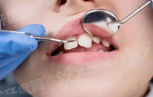 二、北京牙元素口腔医院怎么样？（正规靠谱，技术精良，医生专精）yanke.yadoo.cn