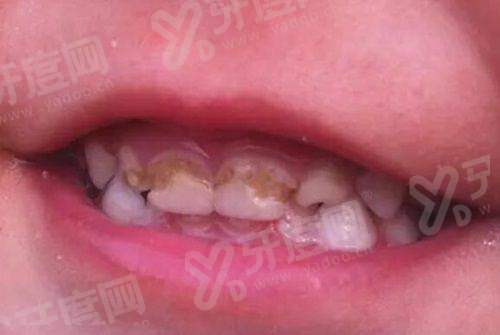 中百口腔医院是莆田系吗？非莆田系机构！天津/济宁/天水中百口腔地址/价格全公开