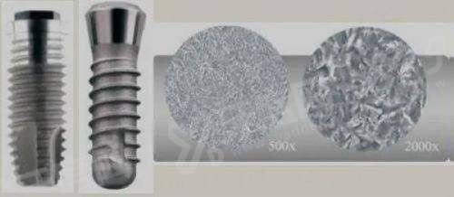 瑞士tplus和登腾种植牙哪个好用？前者四级纯钛材质/后者性价比高