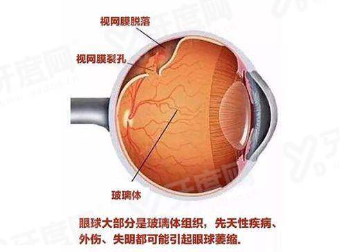 四院眼科怎么网上挂号？教你按流程操作，还有24小时电话咨询及坐车指南