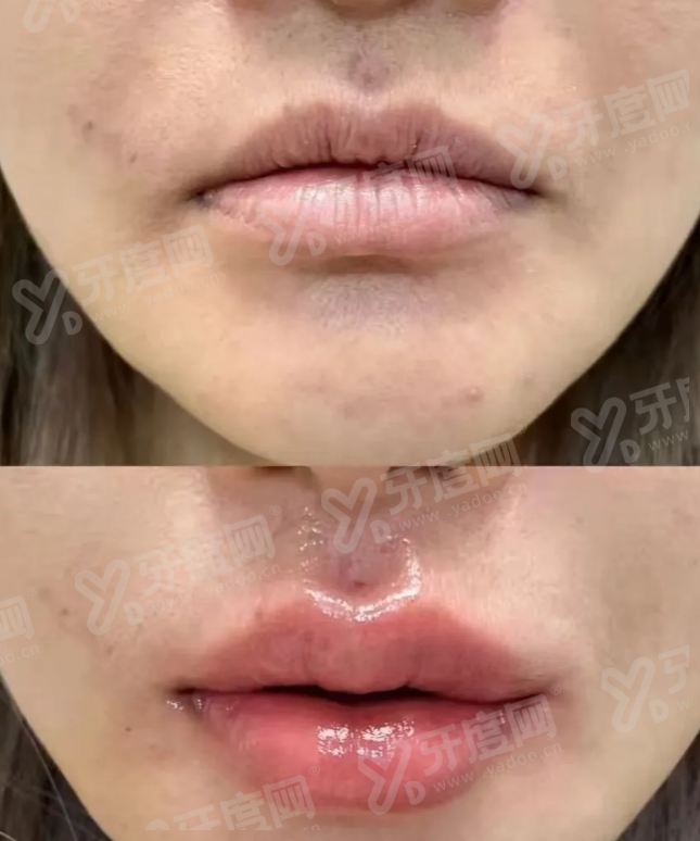 二、凯婷人鱼体雕正规吗yanke.yadoo.cn