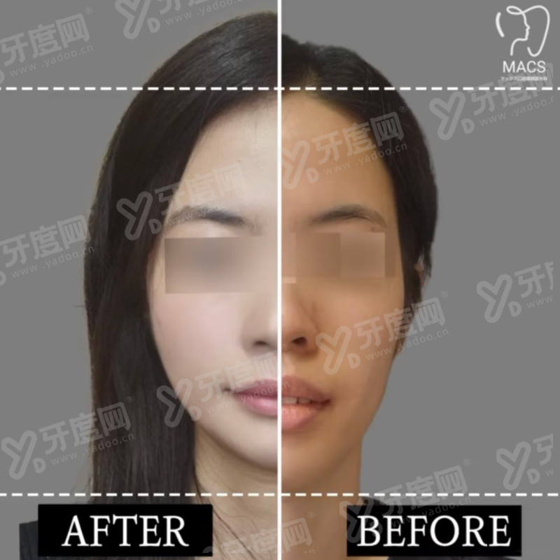 二、介绍广州光华口腔医院怎么样？（正规可靠，技术实力强）yanke.yadoo.cn