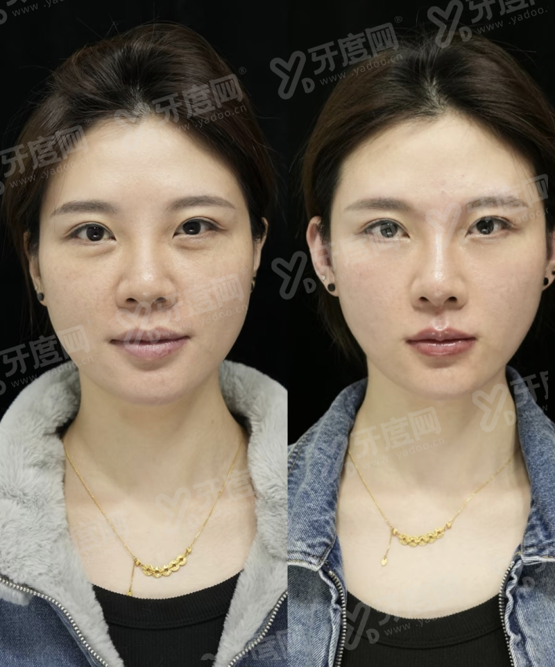 三、介绍正睿齿科地址在哪里？（多院区覆盖核心区域，交通便利）yanke.yadoo.cn