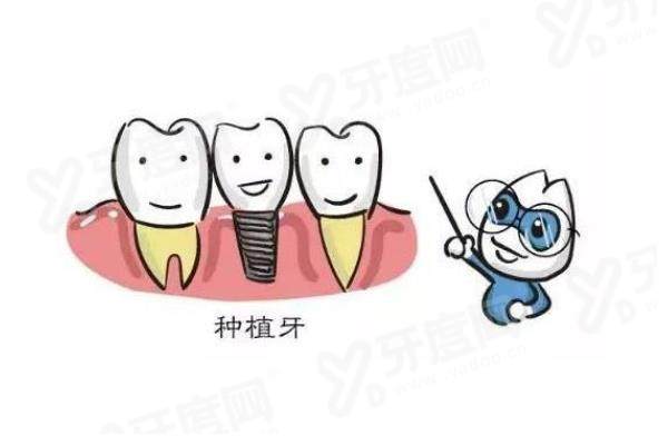 韩国维钛种植牙优缺点及价格？优点多稳定性强且价格合理，与登腾对比解析来了 