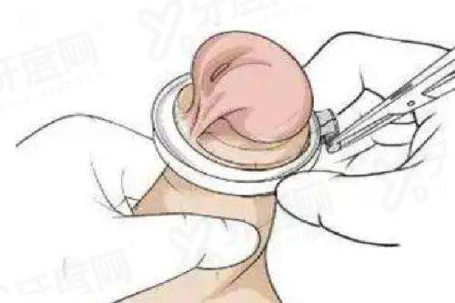 二、祝东升医生做面部拉皮实例内容条理清晰yanke.yadoo.cn